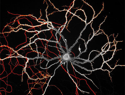 Die Wissenschaftler endeckten einen Mechanismus der die Dopamin-ausschüttenden Nerven …