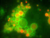 Die Immunfluoreszenzaufnahme zeigt die Endosomen einer Zelle in der Umgebung des Zell …