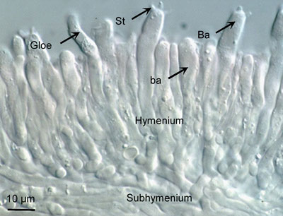 Hericium Coralloides Lichtmikroskopie