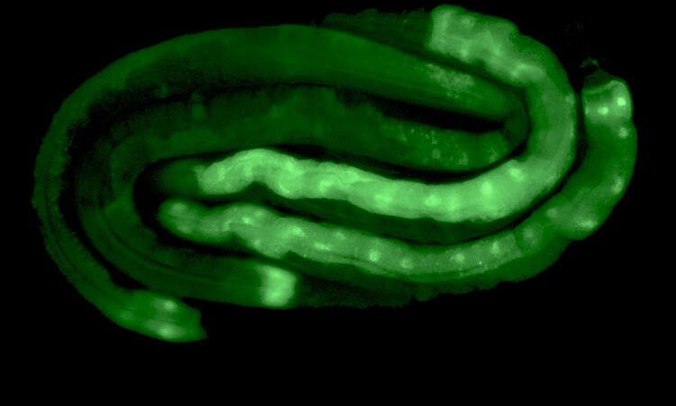 Fadenwürmer (Species Caenorhabditis elegans) unter dem Mikroskop im Fluoreszenzlicht