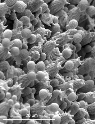 Hericium Coralloides Rasterelektornenmikroskop