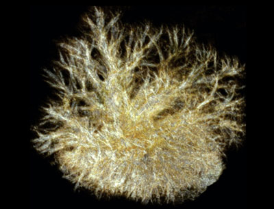 Hericium Coralloides MRI-Aufnahme