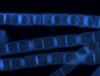 Fluoreszenzmikroskopische Aufnahme der Zygogonium ericetorum, zur Darstellung der Zel …
