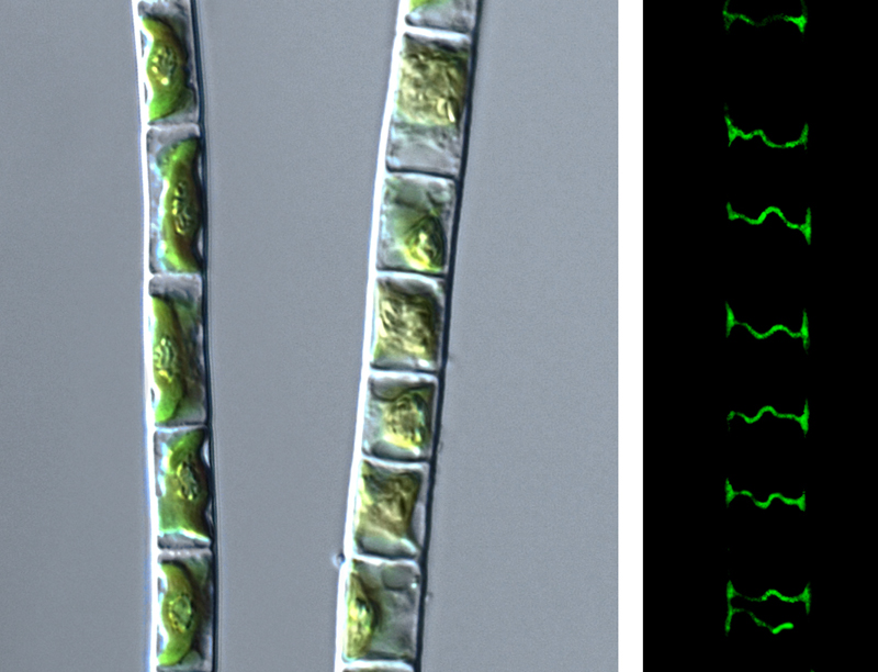 Das Bild zeigt die Grünalge Klebsormidium crenulatum im lichtmikroskopischen Bild (li …