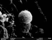 Raster-Elektronenmikroskopisches Bild eines Nanopartikels