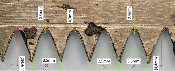Vermessung der Mikroskopaufnahme