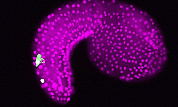 Der Embryo von Ciona intestinalis, Zellen der Epidermis leuchten Magenta, Zellen der sensorischen Nervenzellen im Schwanzbereich leuchten Grün.