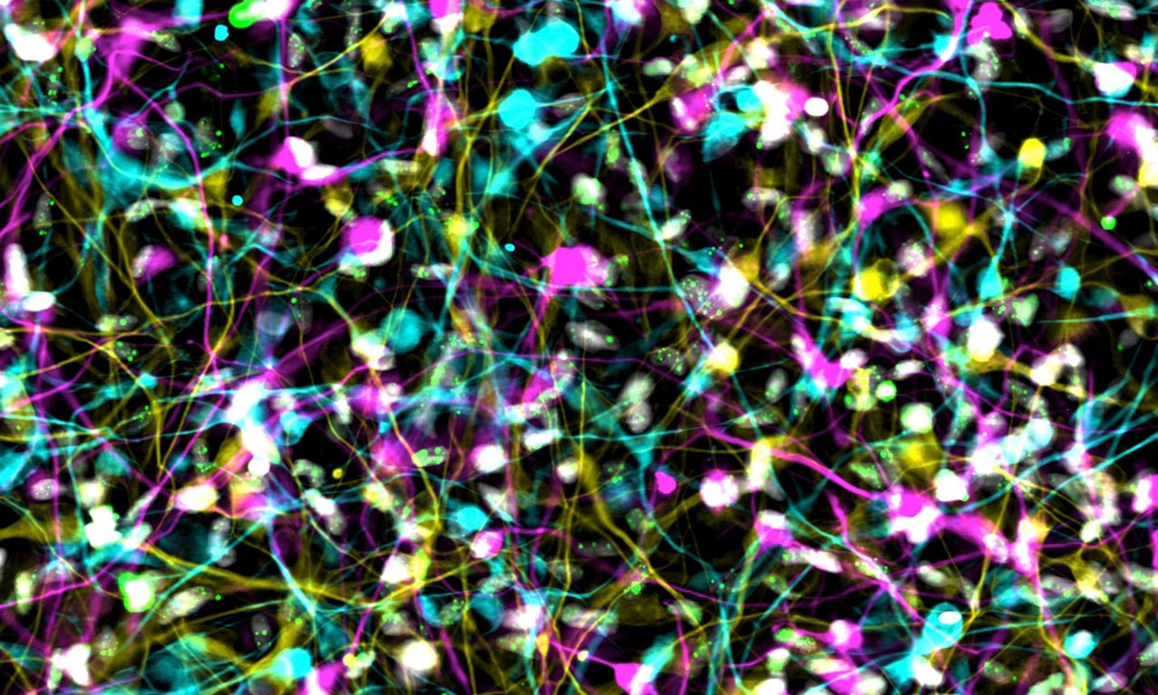Die Abbildung zeigt induzierte Neuronen von Alzheimer-Patient*innen aus einer Immunfluoreszenz-Aufnahme. Die DNA-Schädigungen in diesen Nervenzellen sind durch grüne Punkte sichtbar.
