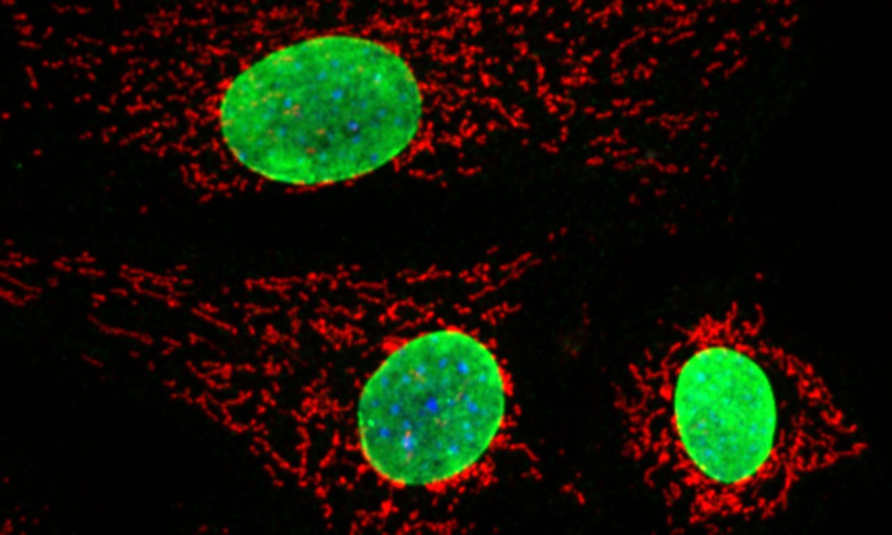 Immunfluoreszenz Aufnahme von Fibroblasten (Bindegewebe) mit einem Konfokalmikroskop: Im Zuge dieser Aufnahme werden Organellen innerhalb der Zellen mit fluoreszierenden Antikörpern markiert. In rot sieht man das mitochondriale Netzwerk, in grün den 