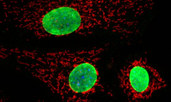 Immunfluoreszenz Aufnahme von Fibroblasten (Bindegewebe) mit einem Konfokalmikroskop: Im Zuge dieser Aufnahme werden Organellen innerhalb der Zellen mit fluoreszierenden Antikörpern markiert. In rot sieht man das mitochondriale Netzwerk, in grün den 