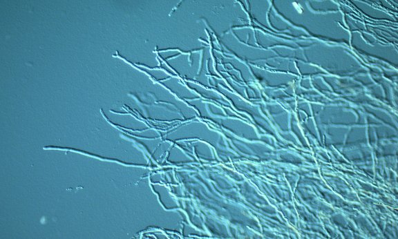 Vergrößerte Sporen, die auf blauem Hintergrund wachsen