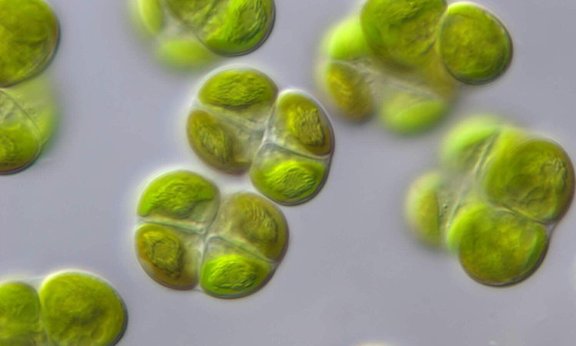 "Chlorokybus" bilden "Zellpakete" und leben in feuchten Böden und Felsspalten