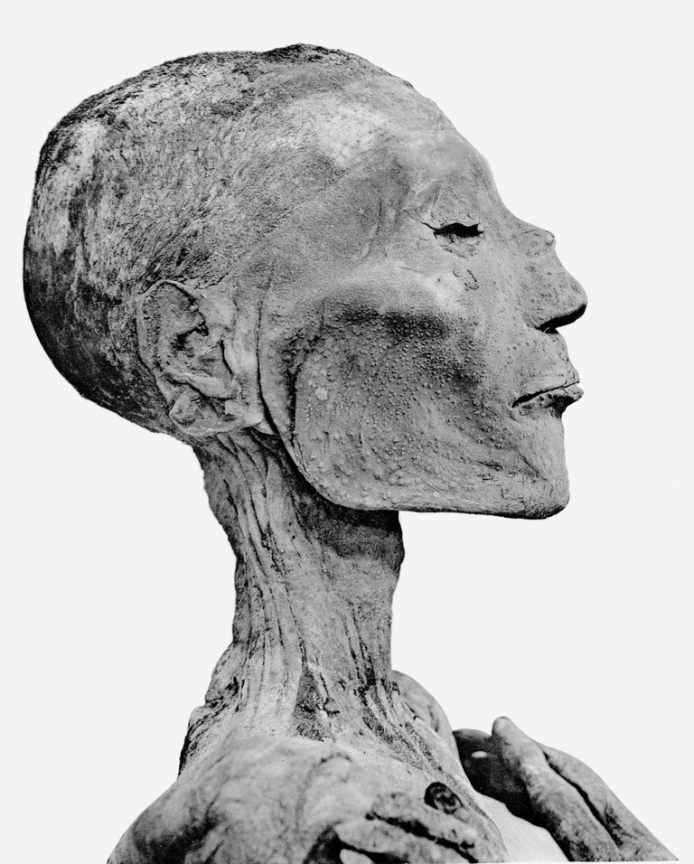 Mumie des Pharaos Ramses V.