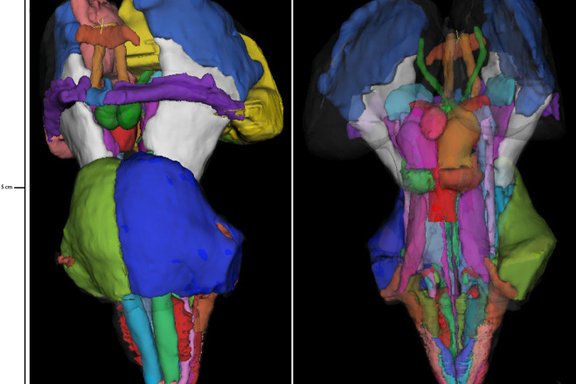 WG1: Brainstem Mapping image
