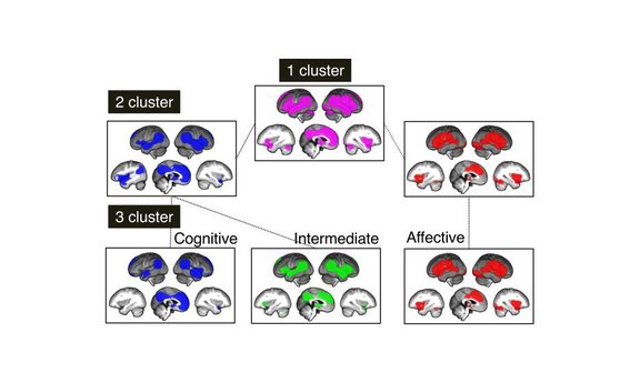 Symbolic picture showing a colorful array of brain clusters.