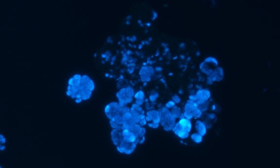 Microscopy picture showing fluorescenting microorganisms