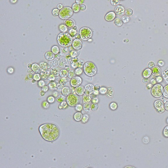 Light-microscopic image of the isolated photobiont, Asterochloris glomerata