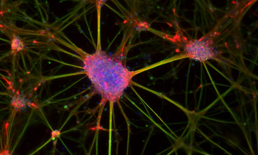 Networking reprogrammierter Nervenzellen