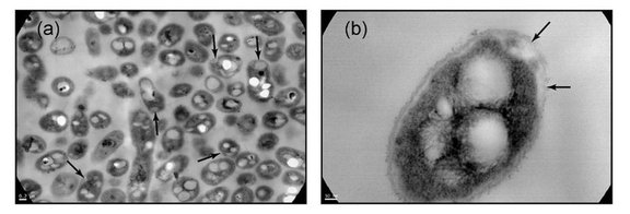 Das PHB produzierende Bakterium Cupriavidus necator mit PHB Granulen in den Zellen
