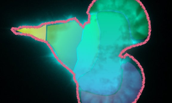 Eingefärbte Mikroskopaufnahme einer Immunzelle, oben und unter ist eine Leiste, die die Bewegungsdynamik symbolisieren soll.