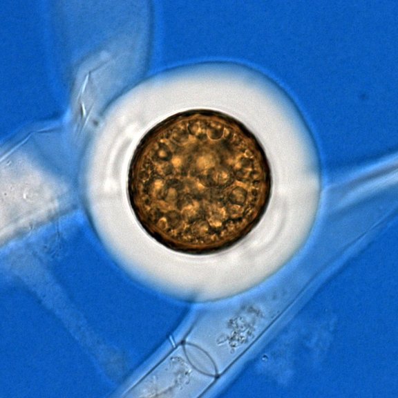 Sexual reproduction of Zygnematopyhceae_Mougeotia_zygospore ink staining