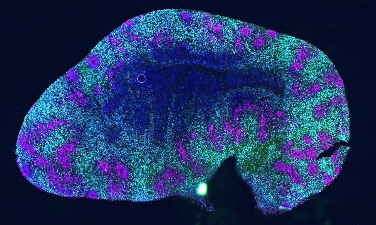 Image of an brain organiod