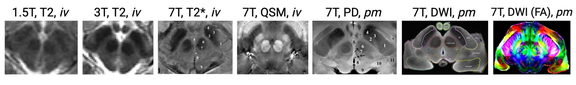 Examples of imaging of the red nucleus and substantia nigra across different field strengths (1.5, 3T, 7T), in vivo or post mortem and with different imaging sequences.