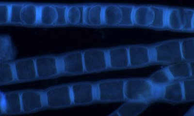 Fluoreszenzmikroskopische Aufnahme der Zygogonium ericetorum