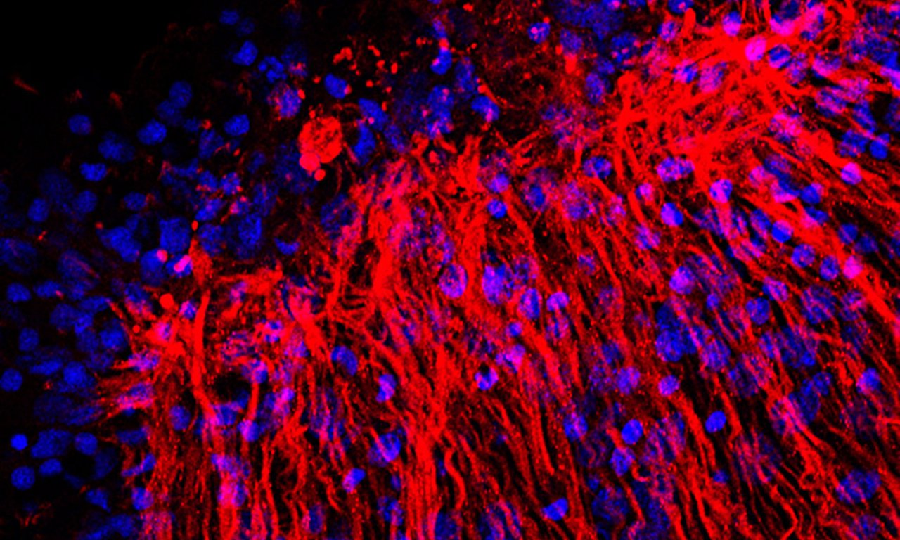 Dyed muscle fibres of a hydra tentacle, in bright blue and red