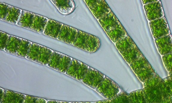 Bild der sequenzierten Sternalge: Zygnema circumcarinatum SAG 698-1b.