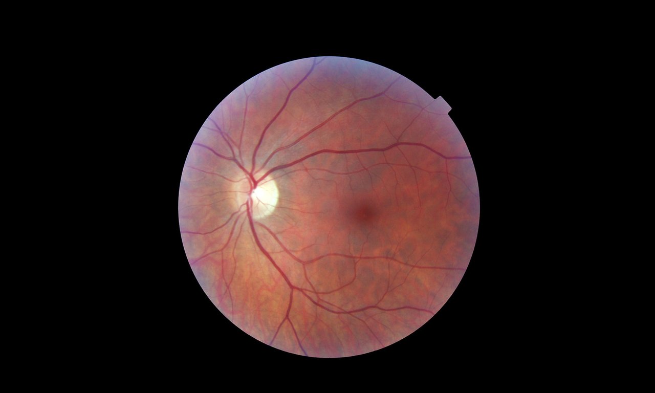 Die menschliche Netzhaut (Retina)