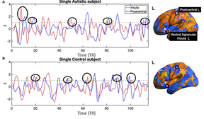 Brain bold signal MRT