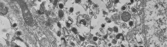 Transmission electron microscope image of chromaffin cells