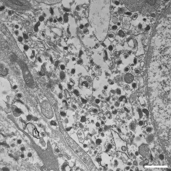 Transmission electron microscope image of chromaffin cells