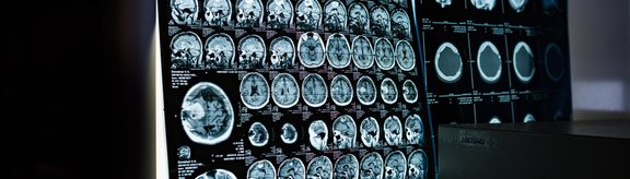 Gehirnscans