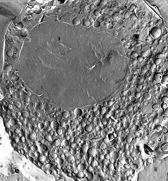 THE CHROMAFFIN CELL encloses a multitude of chromaffin vesicles