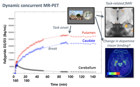 Dopamine release in memory encoding in old age