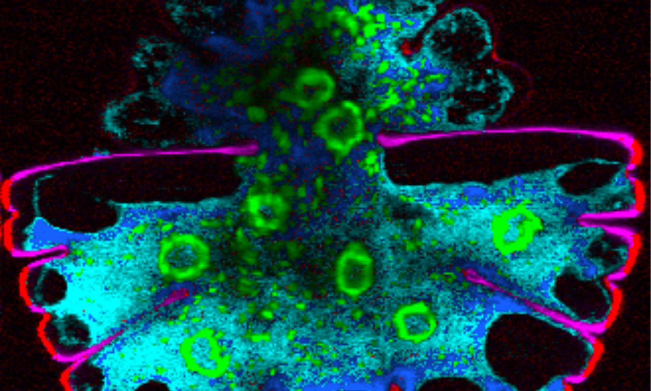 Micrasterias deticulata, Grünalge dargestellt mit RAMAN-Spektroskopie welche ein ‚chemisches Bild‘ unterschiedlicher zellulärer Komponenten wie Zellulose (pink), Stärke (grün), Proteine und Lipide (blau und cyan) ermöglicht.