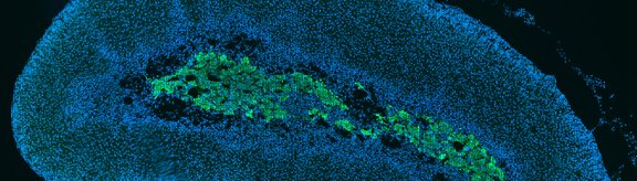 Immunostaining Adrenal gland