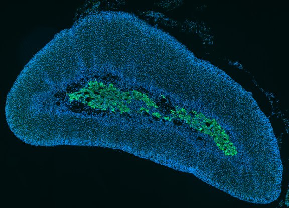 THE CHROMAFFIN CELL encloses a multitude of chromaffin vesicles
