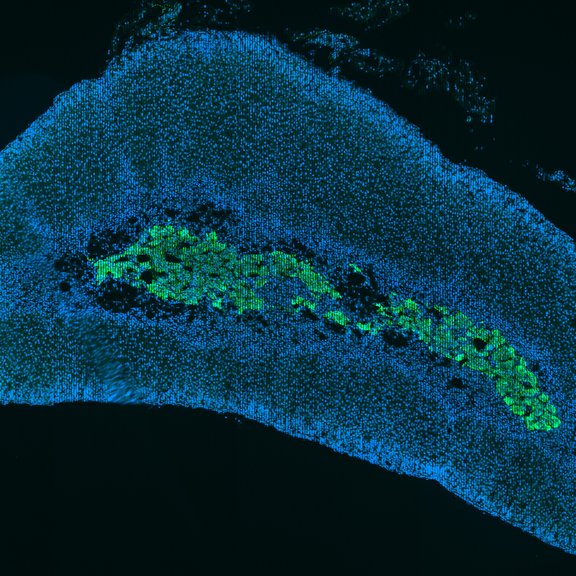THE CHROMAFFIN CELL encloses a multitude of chromaffin vesicles