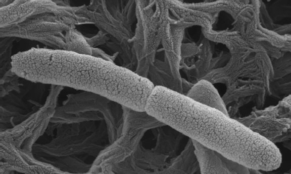 SEM image of strain PM69