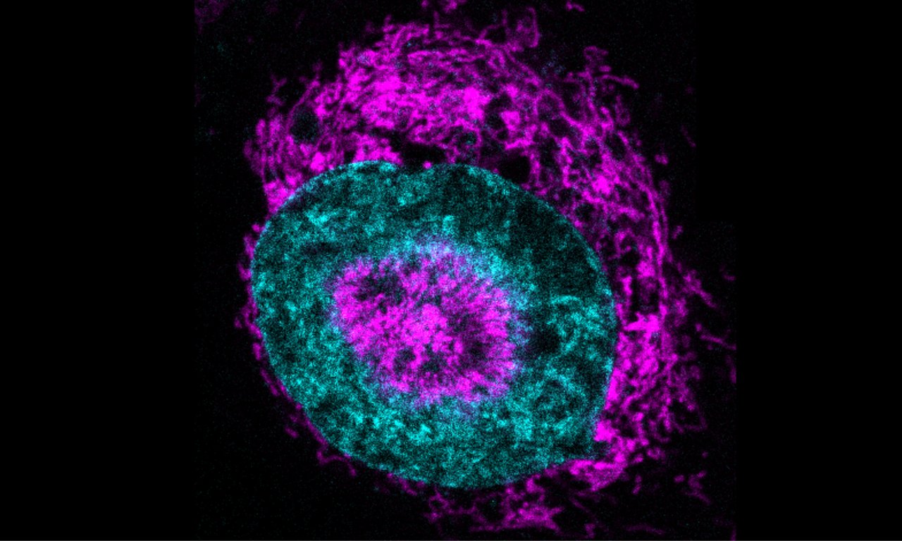 Image of a cell stained purple and blue
