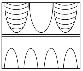 A1/B2_A1 (obere Palmetten mit und ohne Binnenzeichnung (Schuppen), untere ohne)