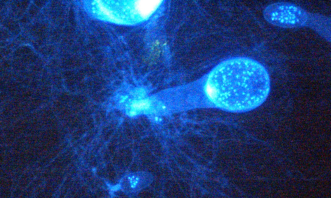 Fluoreszenzmikroskopie