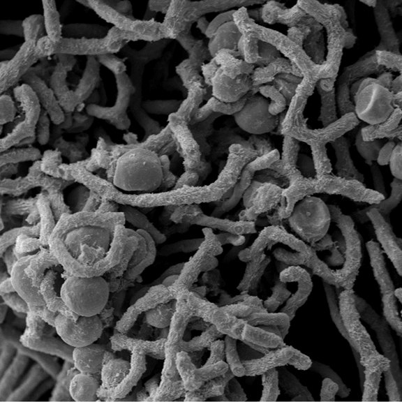SEM image of the two symbionts in the lichen Cladonia grayi. Scale bar: 10 mM.
