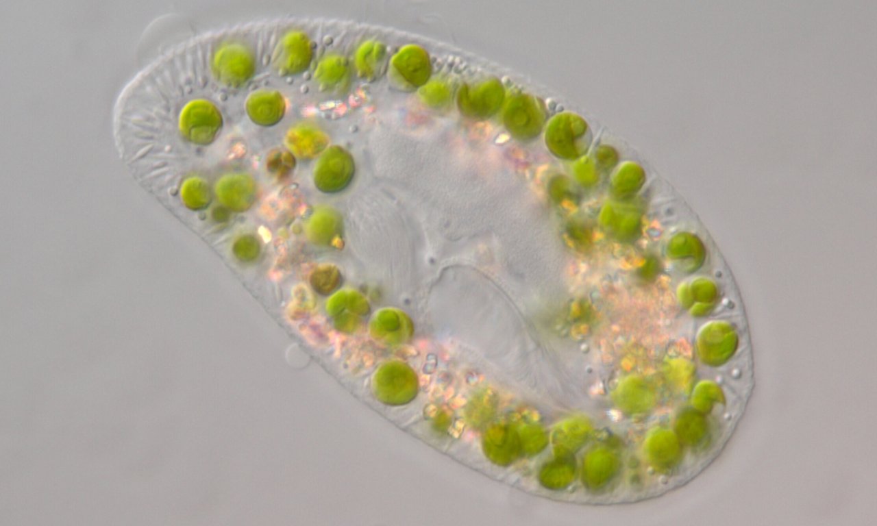 Microscopic image of a ciliate